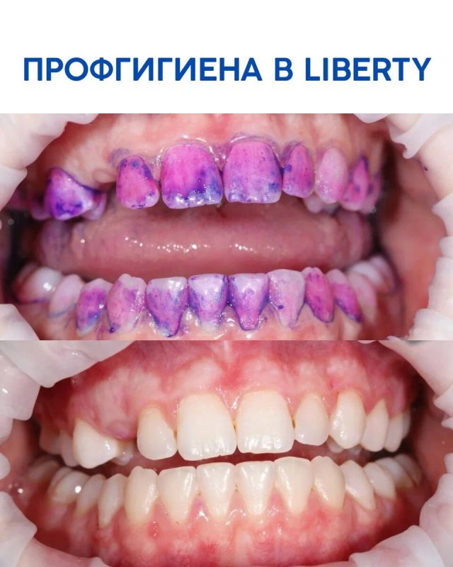 ������ � �������� ����� � ������������ Liberty